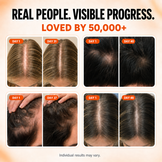 Velaneo™ Hair Growth Serum