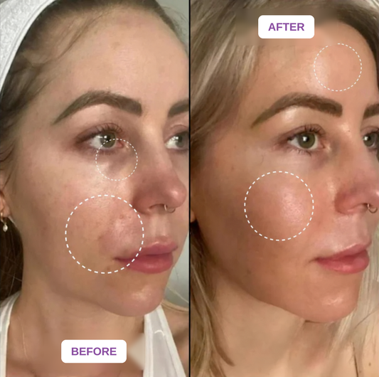 Velaneo Retinal Serum
