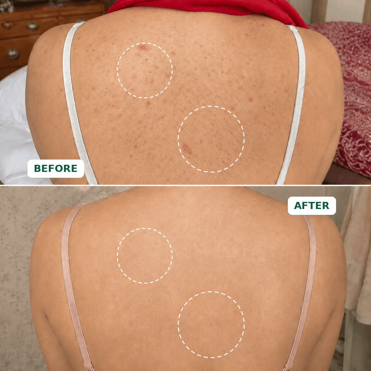 Botanical Dark Spot Care Bar