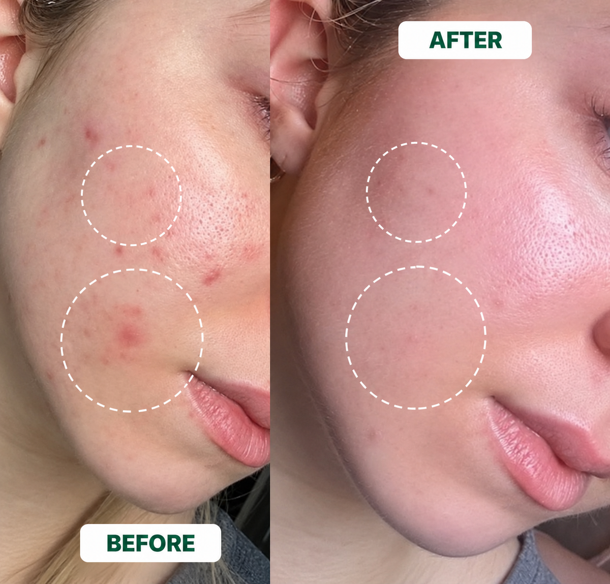 Botanical Dark Spot Care Bar