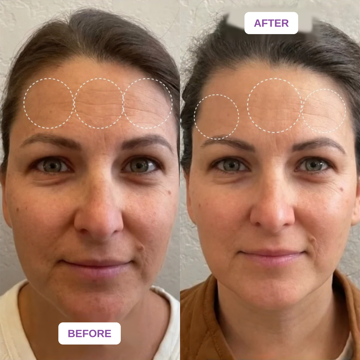 Velaneo Retinal Serum