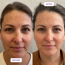 Velaneo Retinal Serum