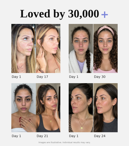 Velaneo Retinal Serum