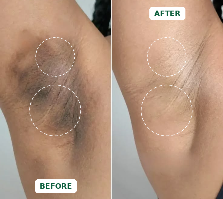 Botanical Dark Spot Care Bar